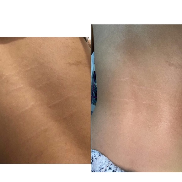 Meet your Posher, MB Distributor, LLC - Picture 10 of 17